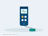 Nerve Stimulator